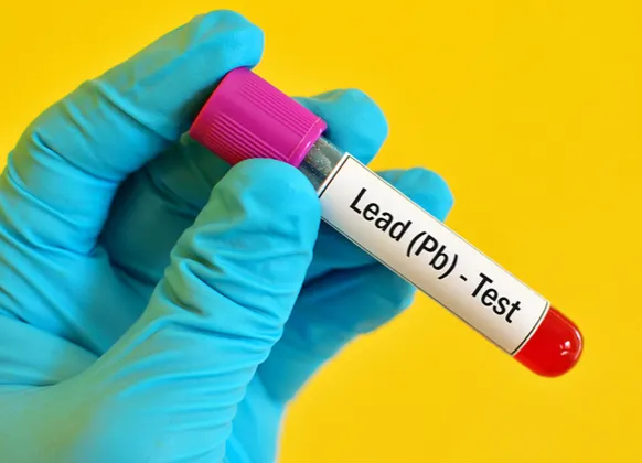 Origin Lead Inspection